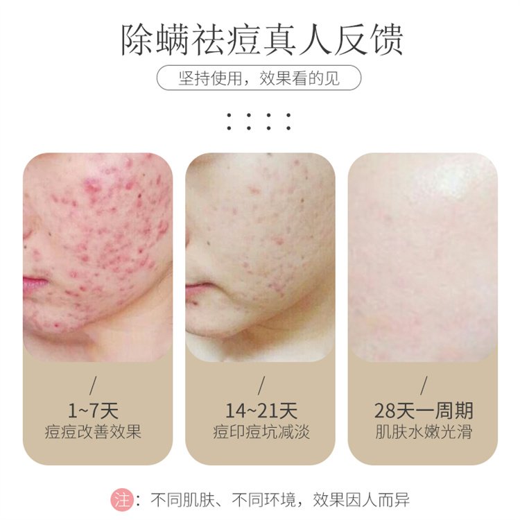 豫皂潔膚皂